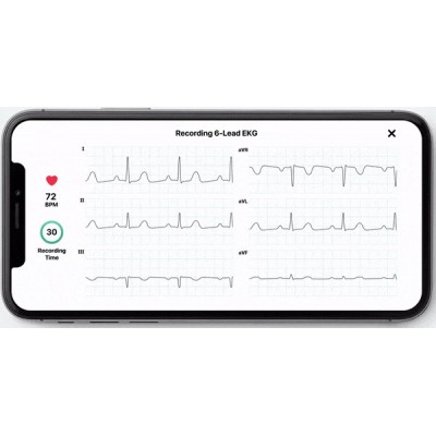 ECG KardiaMobile 6L Alivecor