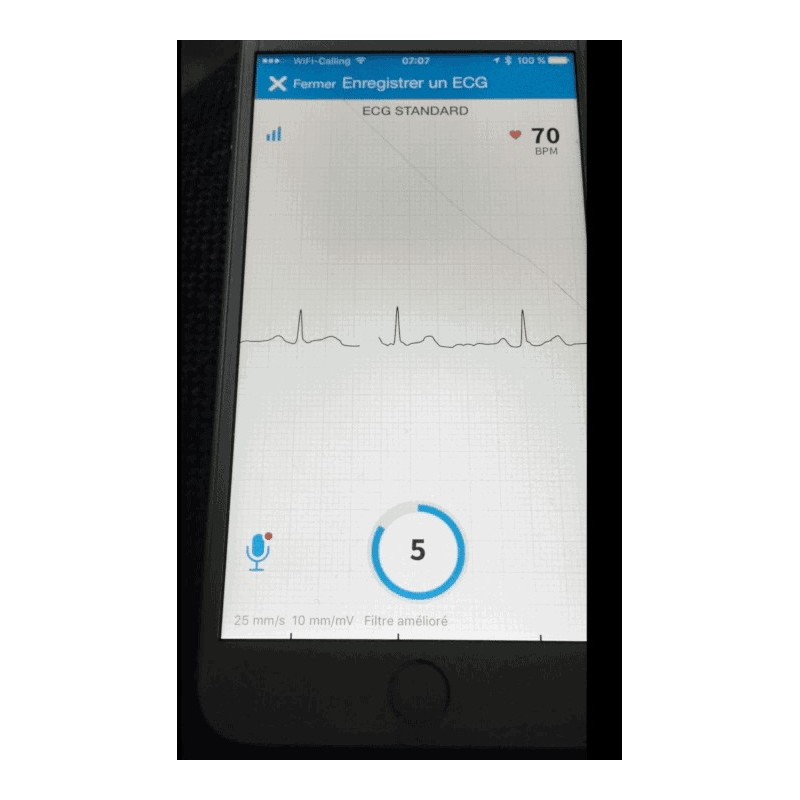 AliveCor Kardia Mobile ECG