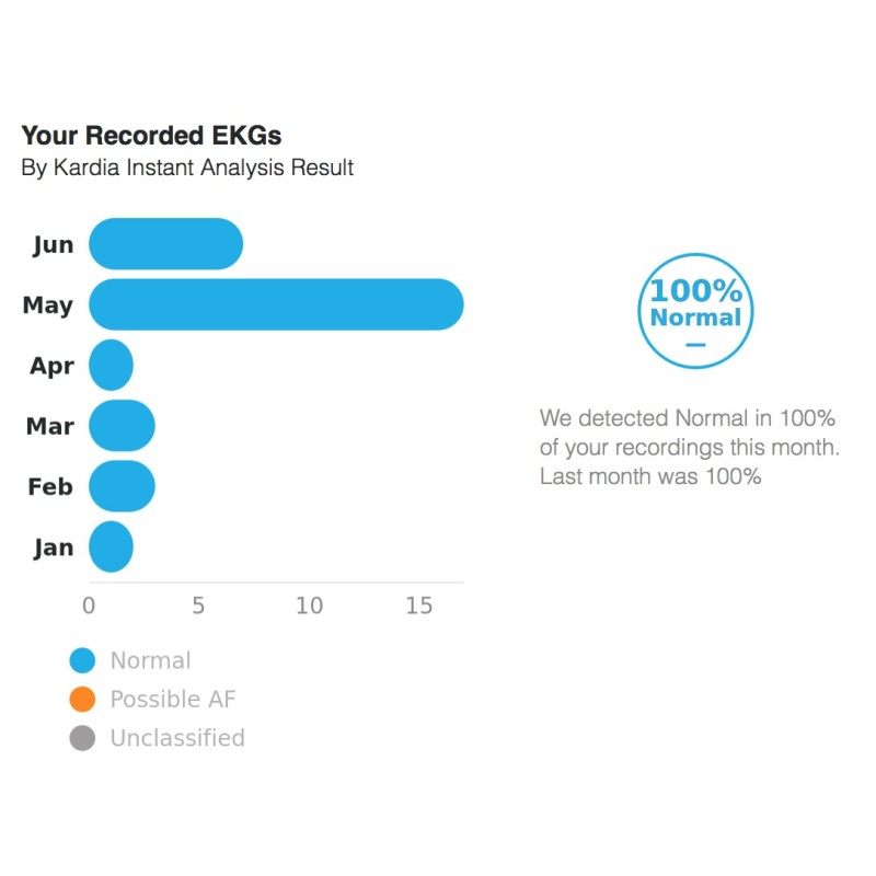 AliveCor Kardia Mobile ECG suivi santé