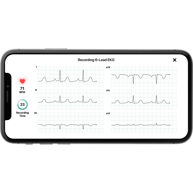 ECG KardiaMobile 6L Alivecor
